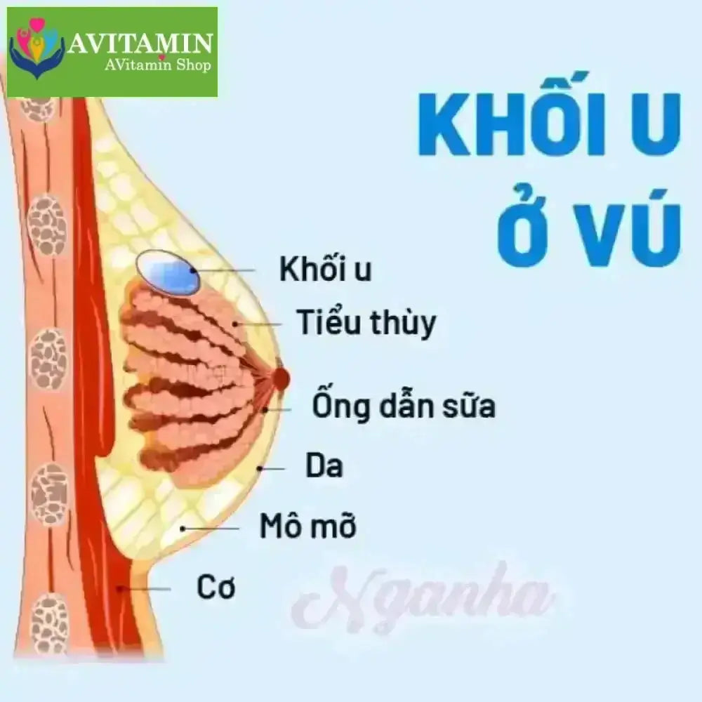 Kem Tan U Bướu Tuyến Vú Senjoko Nhật Bản 50g - Tan U Bướu, U Vú, Giảm Sưng Đau Hạch Nách, Ngực, U Xơ Tuyến Vú Lành Tính - AVITAMINSHOP.COM