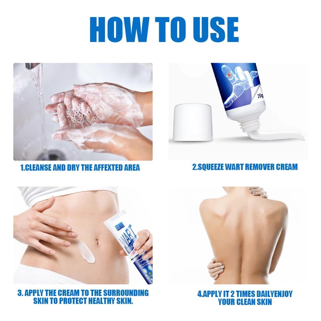 Kem Tẩy Mụn Thịt Và Nốt Ruồi Không Đau - Serum Cho Mụn Ruồi, Tàn Nhang, Đốm Đen, ABBY - AVITAMINSHOP.COM