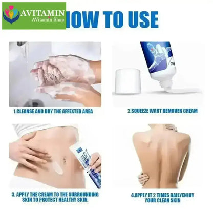 Kem Tẩy Mụn Thịt Và Nốt Ruồi Không Đau - Serum Cho Mụn Ruồi, Tàn Nhang, Đốm Đen, ABBY - AVITAMINSHOP.COM