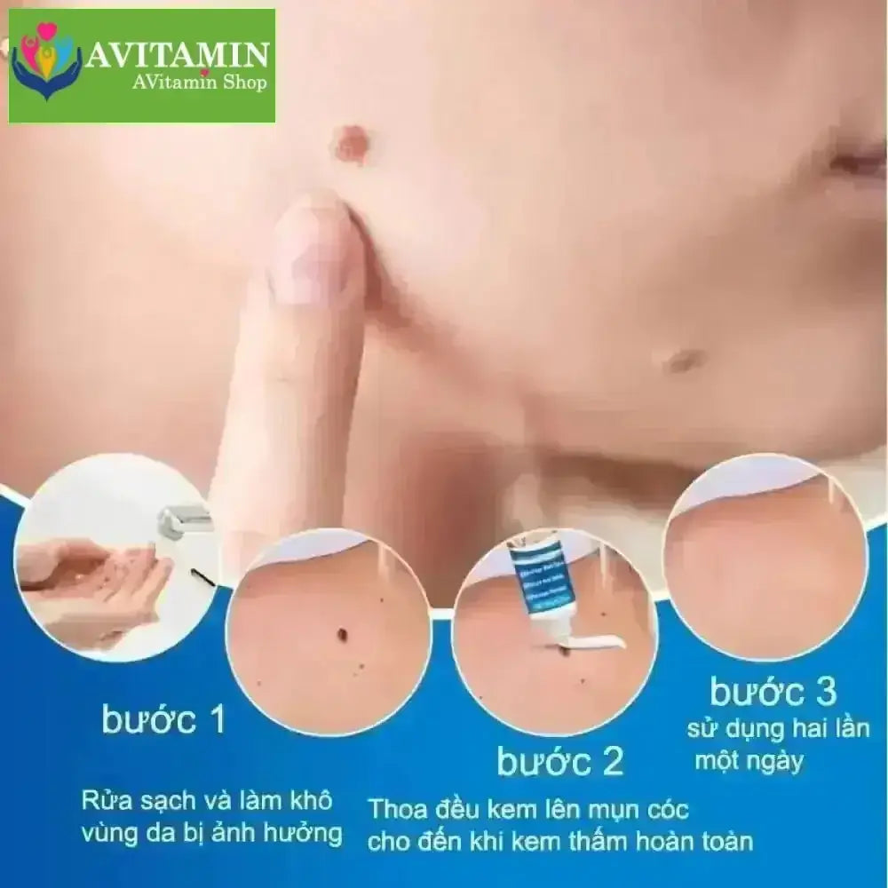 kem tẩy nốt ruồi và lột mụn cóc hiệu quả 20g - AVITAMINSHOP.COM