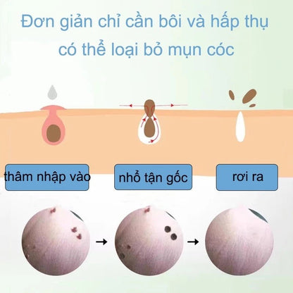 kem tẩy nốt ruồi và lột mụn cóc hiệu quả 20g - AVITAMINSHOP.COM