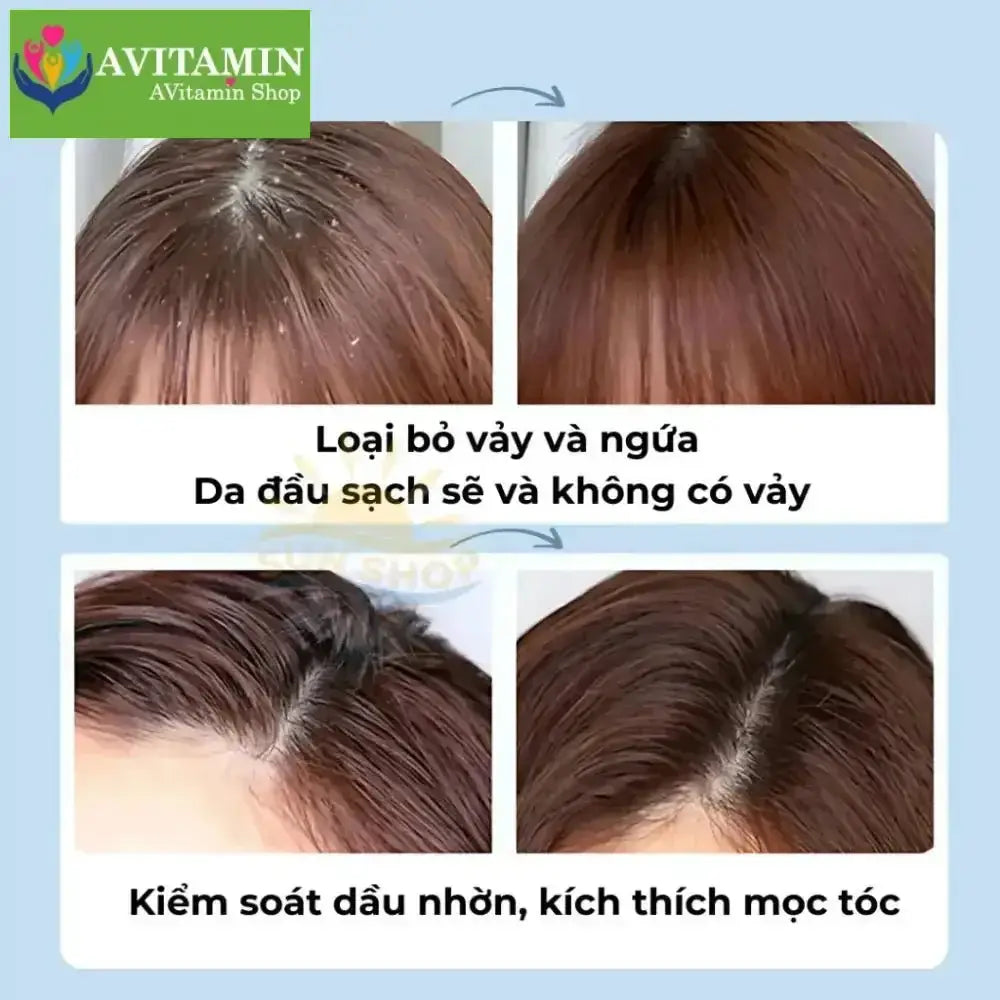 MAIGOOLE - Dầu Gội Chống Gầu Loại Bỏ Nấm Ngứa Da Đầu Nhật Bản, Dứt Điểm Nấm Ngứa, Viêm, Tóc Gãy Rụng Xơ Rối - AVITAMINSHOP.COM