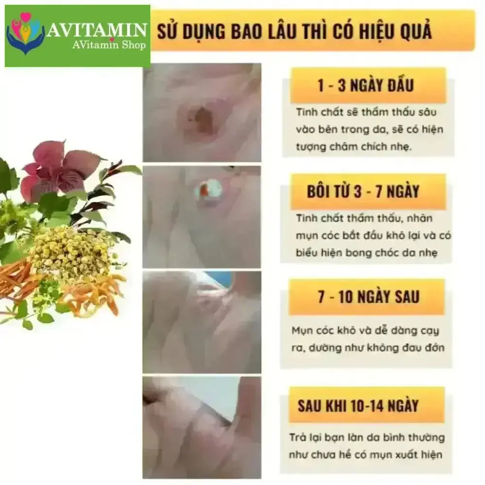 Tinh Chất Thảo Mộc NUNAMIN 15ML - Hỗ Trợ Xử Lý Mụn Cóc, Mụn Thịt, Mắt Cá Chân Tay - AVITAMINSHOP.COM