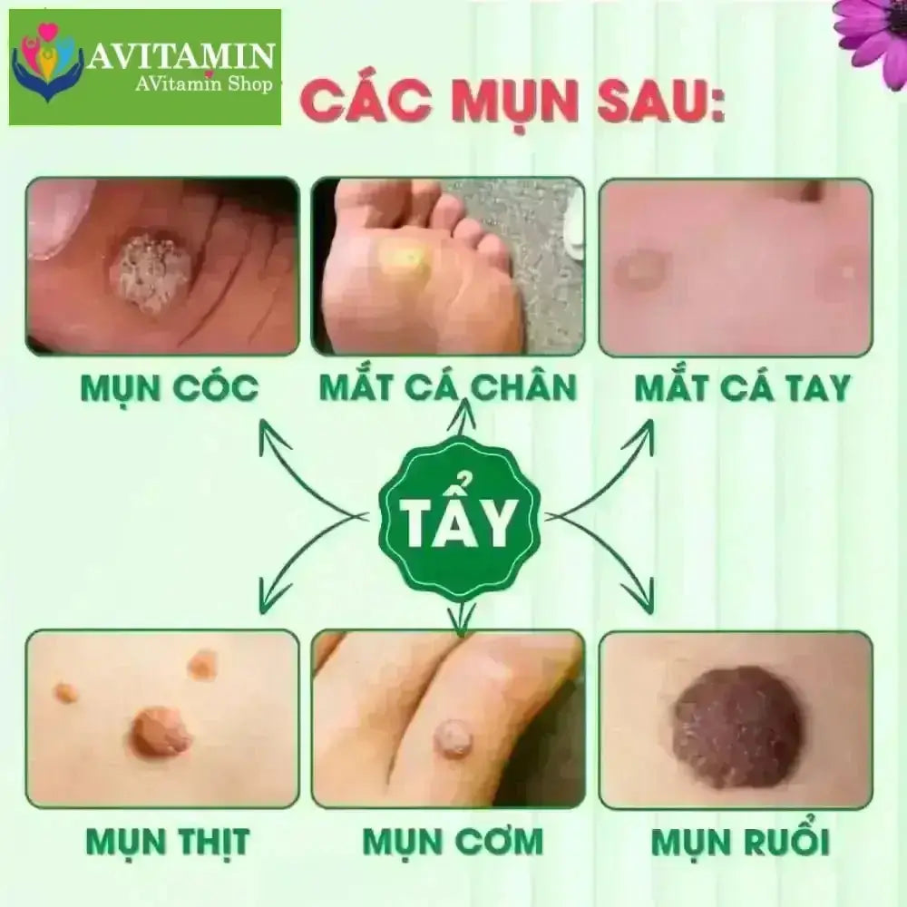 Tinh Chất Thảo Mộc NUNAMIN 15ML - Hỗ Trợ Xử Lý Mụn Cóc, Mụn Thịt, Mắt Cá Chân Tay - AVITAMINSHOP.COM