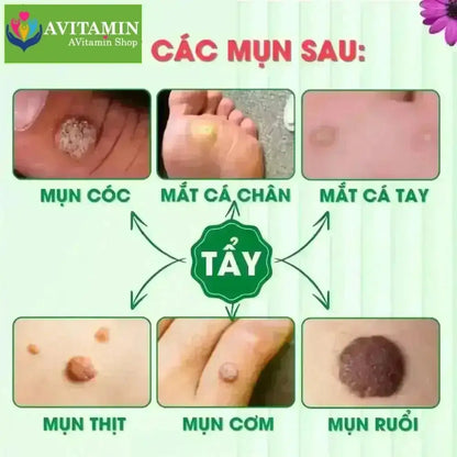 Tinh Chất Thảo Mộc NUNAMIN 15ML - Hỗ Trợ Xử Lý Mụn Cóc, Mụn Thịt, Mắt Cá Chân Tay - AVITAMINSHOP.COM