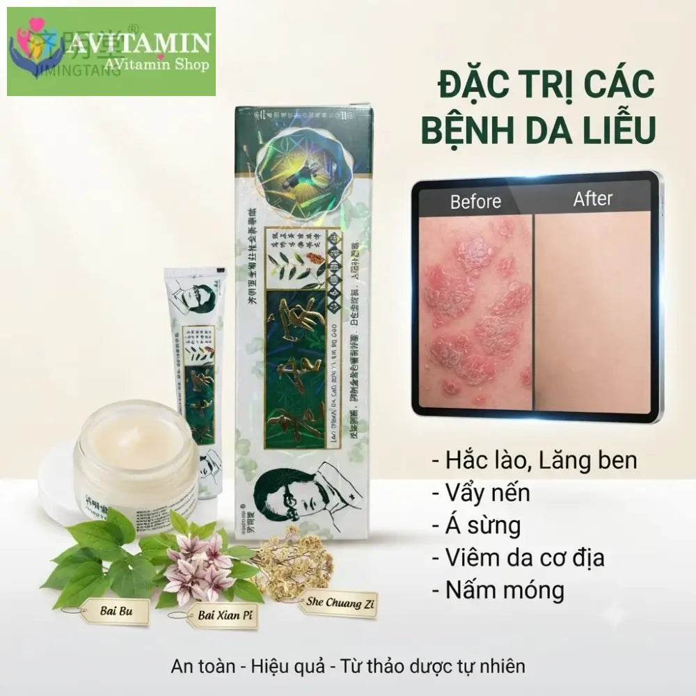 Xanh La)) Kem bôi á sừng nấm ngứa ngoài da 15gr