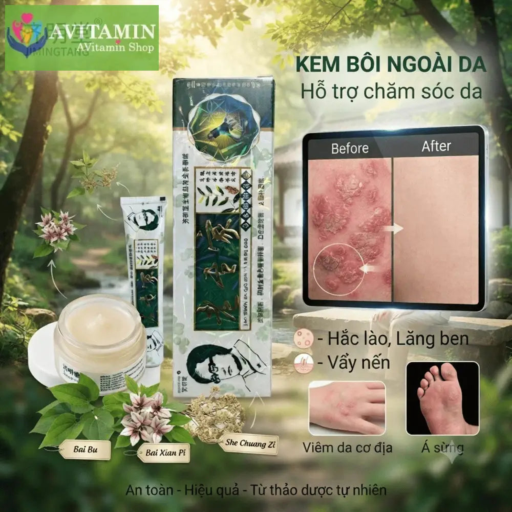 Xanh La)) Kem bôi á sừng nấm ngứa ngoài da 15gr
