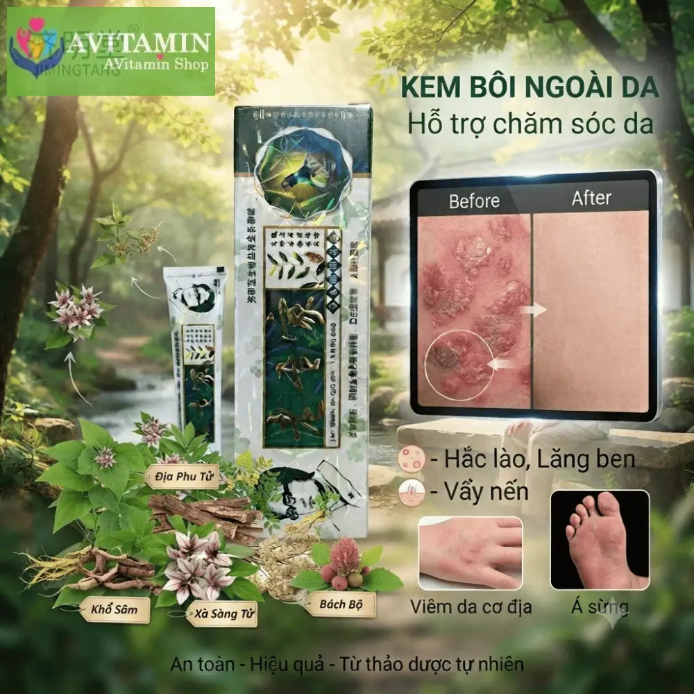 Xanh La)) Kem bôi á sừng nấm ngứa ngoài da 15gr
