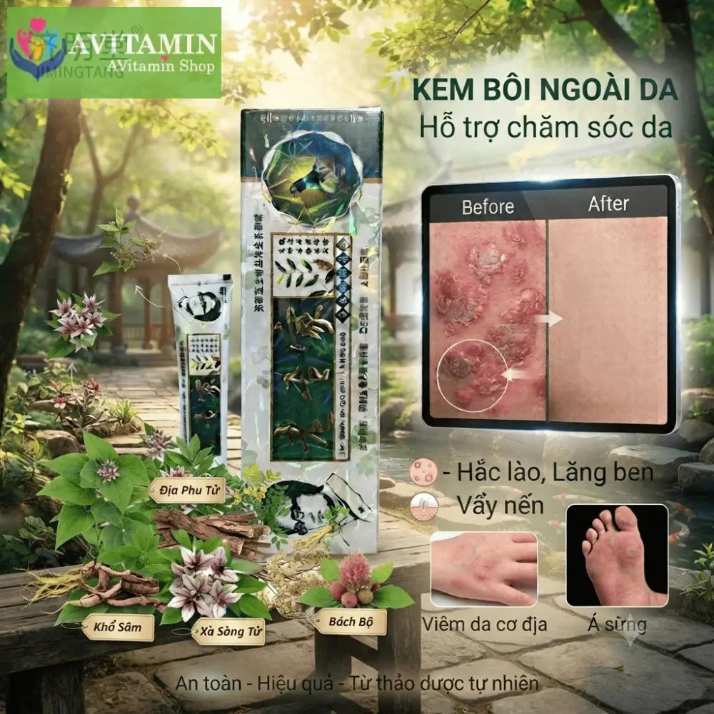 Xanh La)) Kem bôi á sừng nấm ngứa ngoài da 15gr