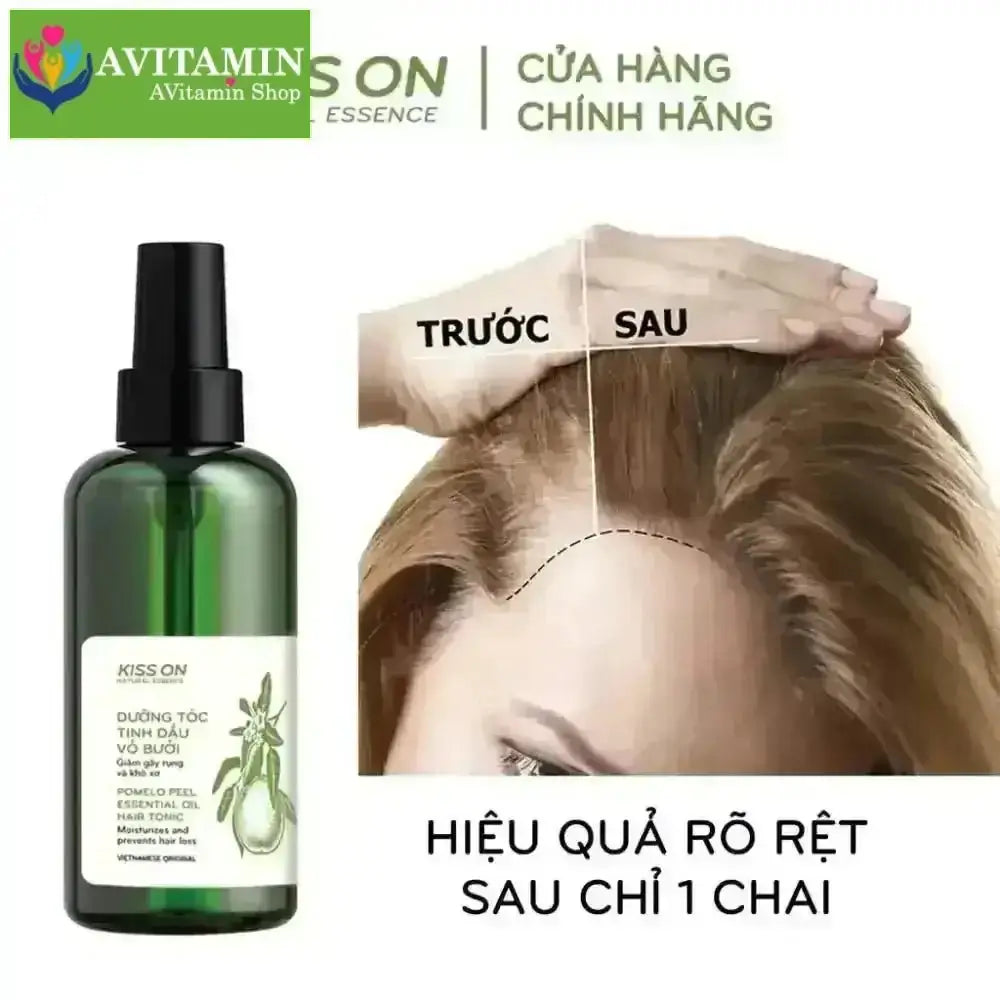 Xịt dưỡng tóc tinh dầu vỏ bưởi KISS ON 145 ml - Giúp ngăn ngừa rụng tóc, hỗ trợ nang tóc phát triển - AVITAMINSHOP.COM