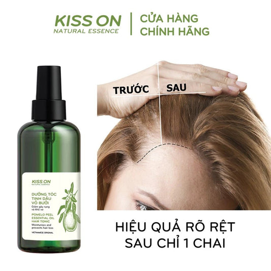 Xịt dưỡng tóc tinh dầu vỏ bưởi KISS ON 145 ml - Giúp ngăn ngừa rụng tóc, hỗ trợ nang tóc phát triển - AVITAMINSHOP.COM