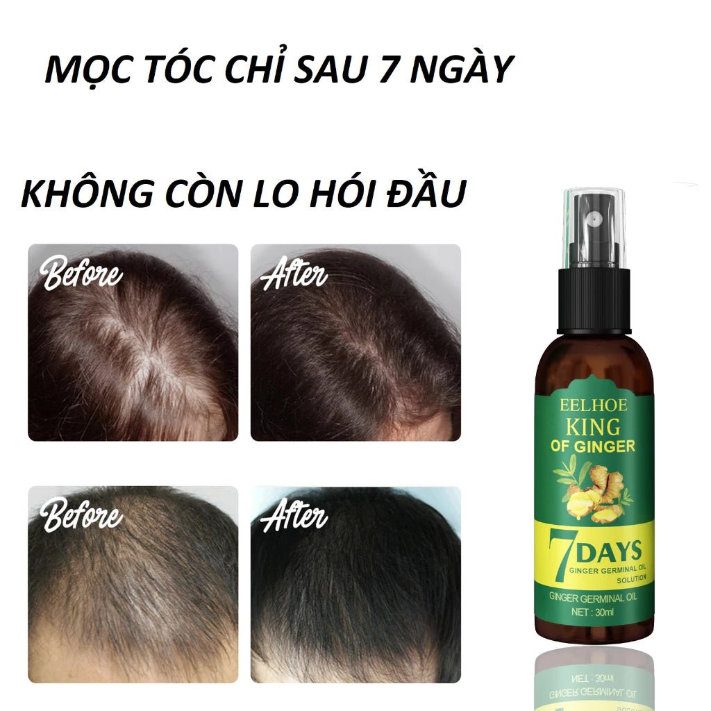 Xịt mọc tóc EELHOE tinh chất gừng tươi không chứa silicon kích thích mọc tóc sau 7 ngày 30ml - AVITAMINSHOP.COM