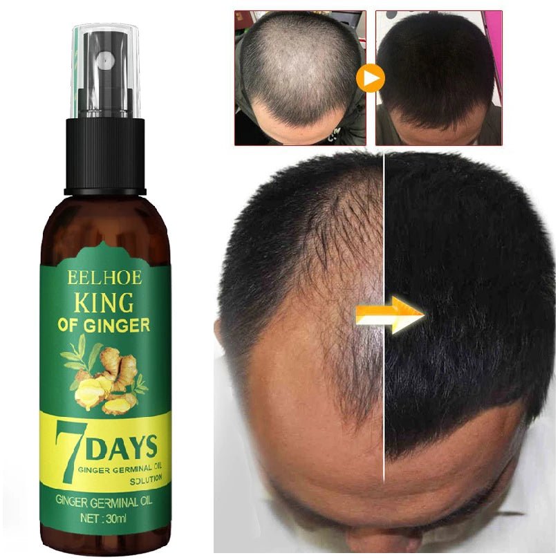Xịt mọc tóc EELHOE tinh chất gừng tươi không chứa silicon kích thích mọc tóc sau 7 ngày 30ml - AVITAMINSHOP.COM