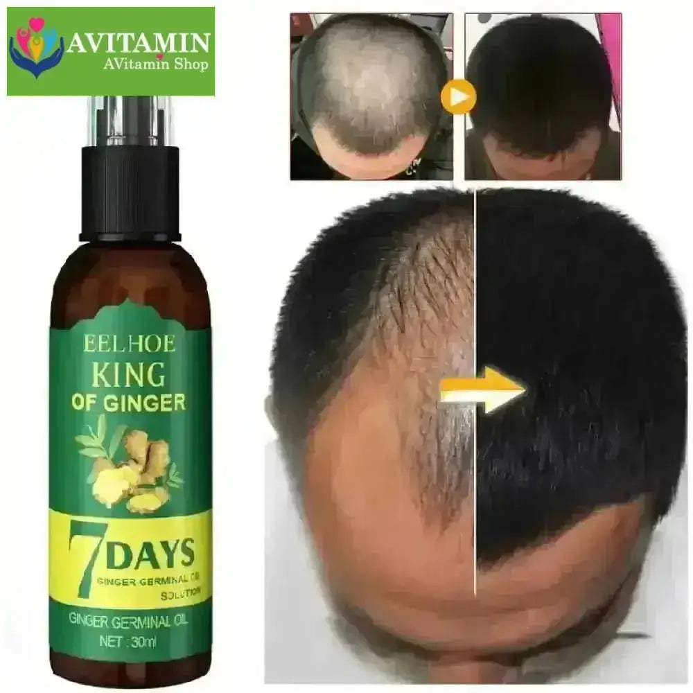 Xịt mọc tóc EELHOE tinh chất gừng tươi không chứa silicon kích thích mọc tóc sau 7 ngày 30ml - AVITAMINSHOP.COM