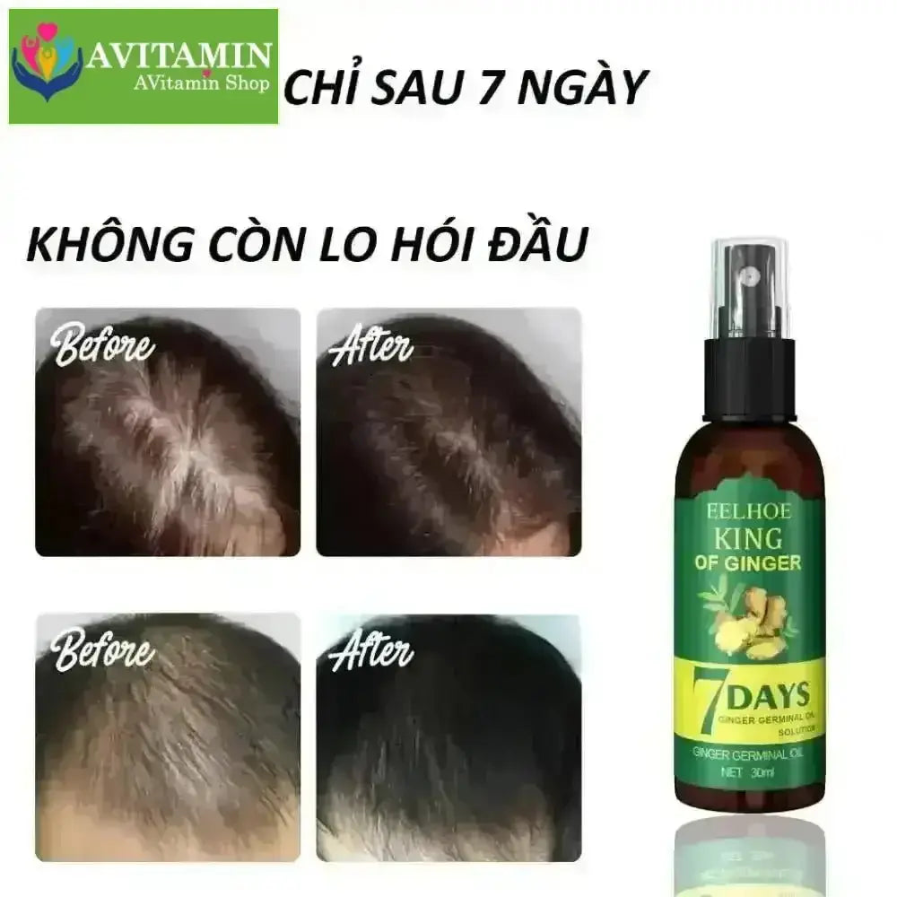Xịt mọc tóc EELHOE tinh chất gừng tươi không chứa silicon kích thích mọc tóc sau 7 ngày 30ml - AVITAMINSHOP.COM